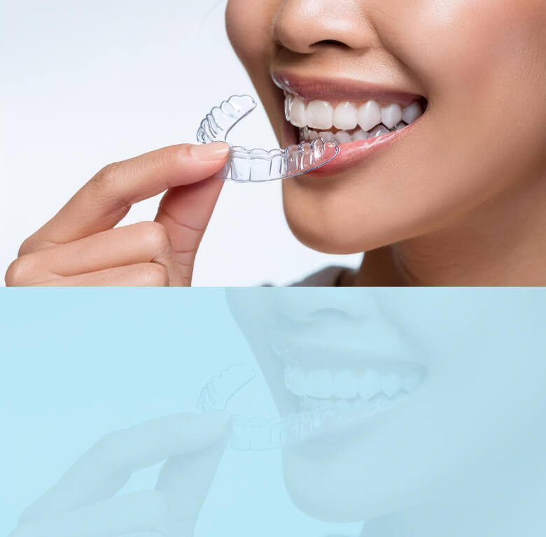 マウスピース矯正を取り外す女性